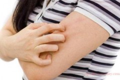 What causes itchy skin in winter