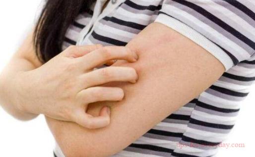 What causes itchy skin in winter1