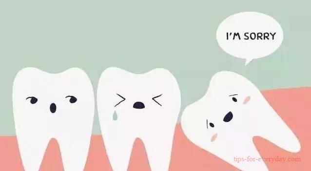 What to do if wisdom teeth are inflamed and swollen?1