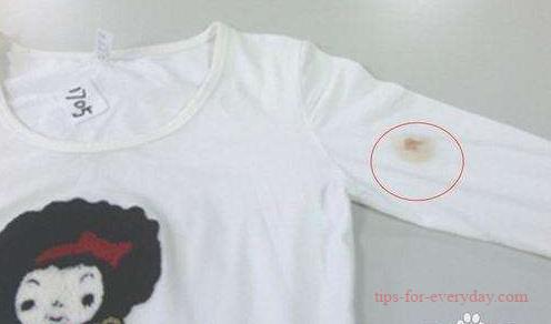 How to remove blood stains from clothes?1